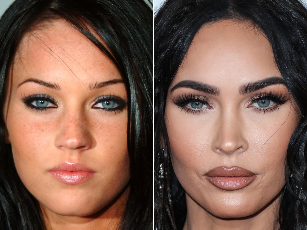 Photo: megan fox too much plastic surgery